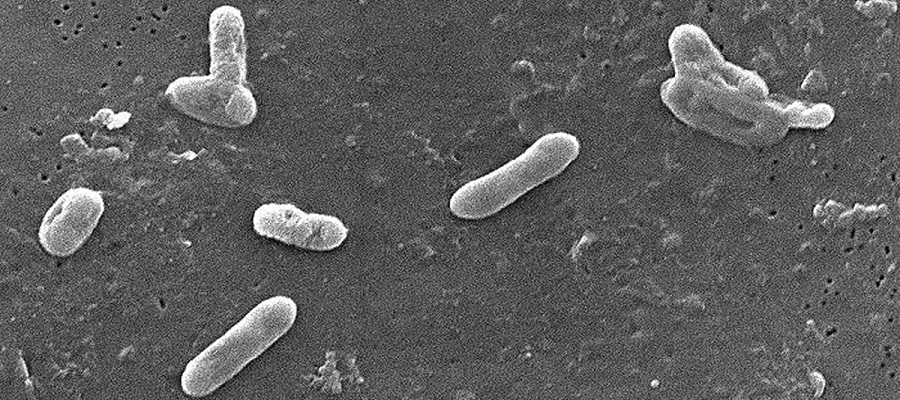 Bakterie Bordetella bronchiseptica jako původce psinkového kašle